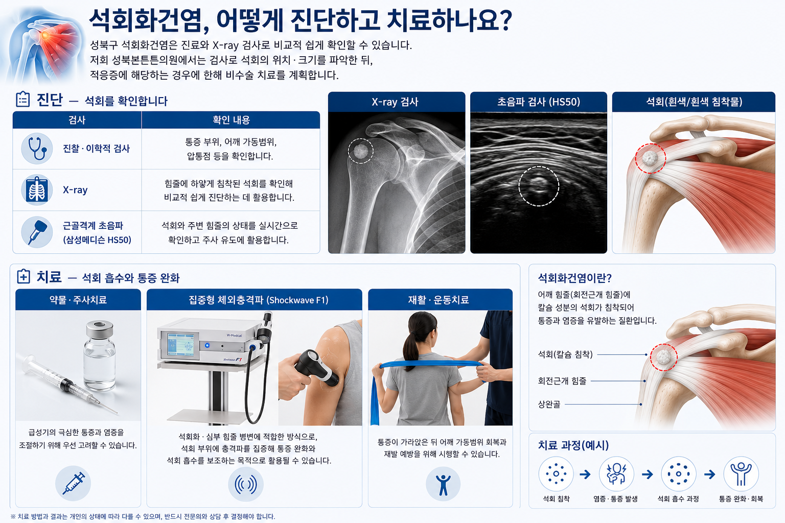 성북구 정형외과 석회화건염 - 갑자기 어깨가 극심하게 아프다면 성신여대입구역 성북본튼튼의원