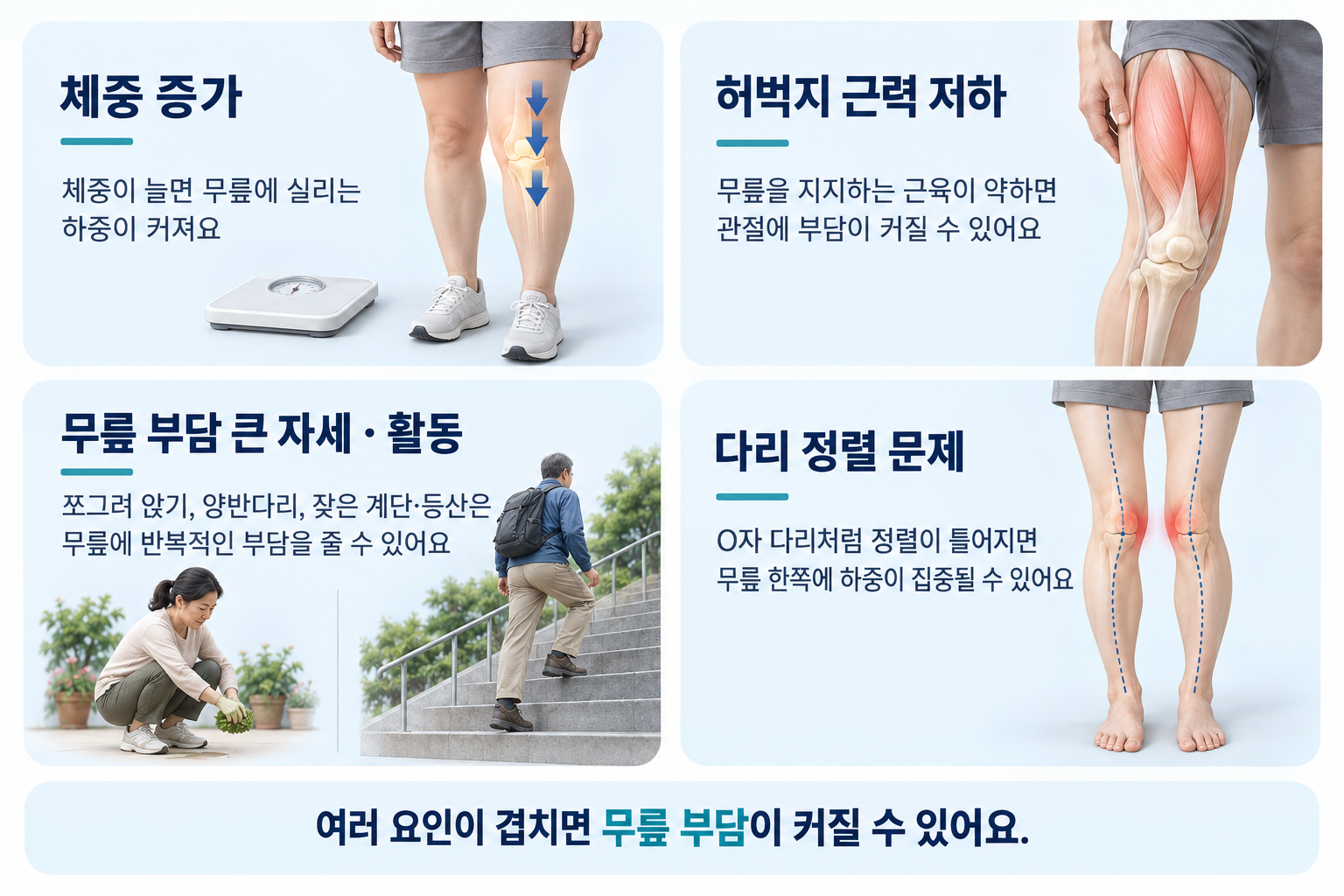 체중, 허벅지 근력, 자세·활동, 다리 정렬이 무릎 부담에 미치는 영향을 설명한 그림